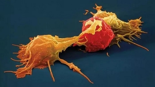 nk细胞—抗癌第一道防线