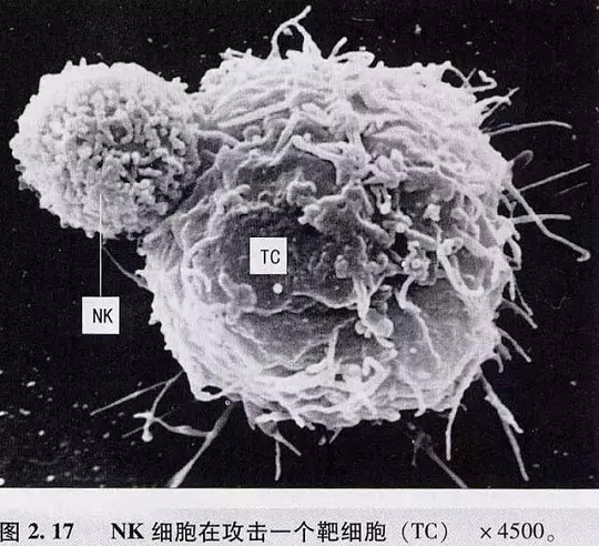 NK干细胞存储有什么用